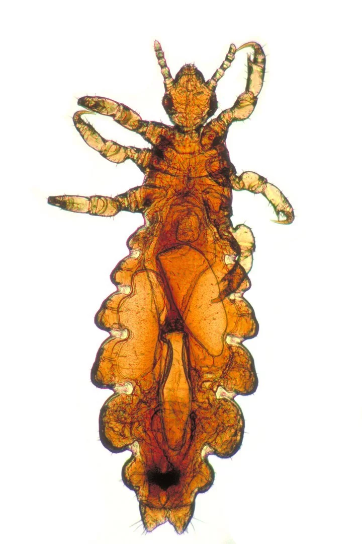 Вошь головная (Pediculus humanus capitis); самка