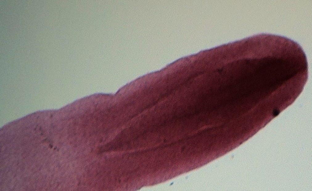 Diphyllobothrium latum (сколекс с ботриями)