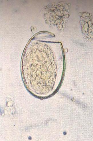 Diphyllobothrium latum (яйцо)