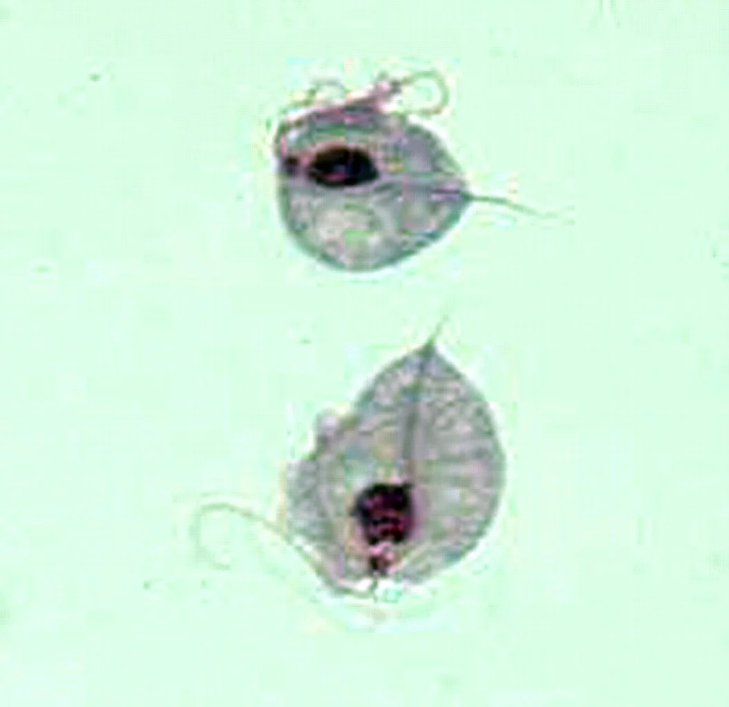 Trichomonas vaginalis