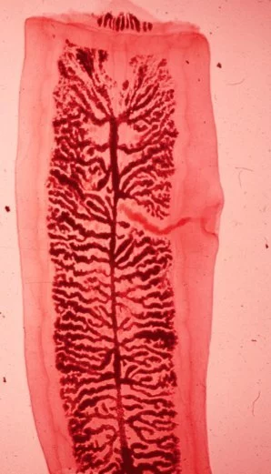 Тaeniarhynchus saginatus (зрелая проглоттида)