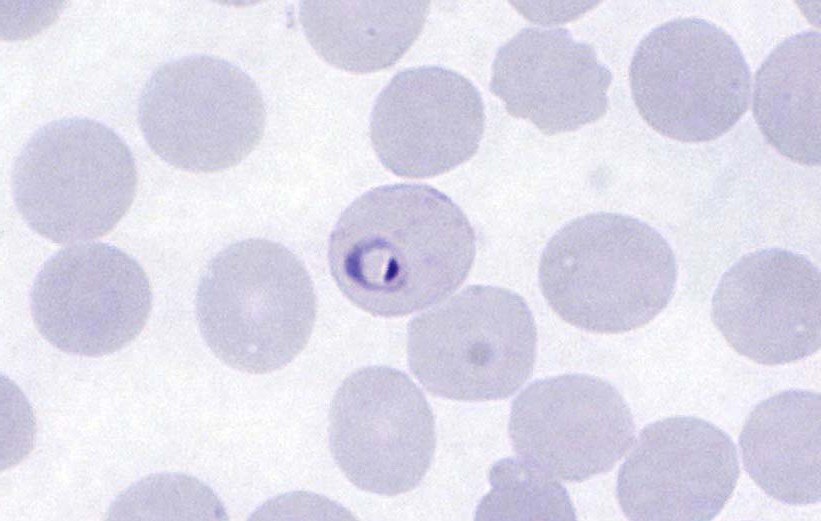 Plasmodium falciparum (кольцо)