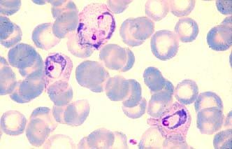 Plasmodium vivax (амёбовидный шизонт)