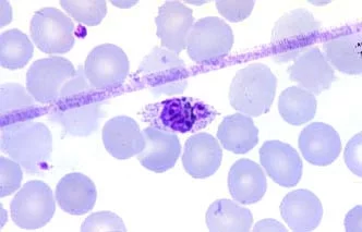 Plasmodium ovale (зрелый шизонт)