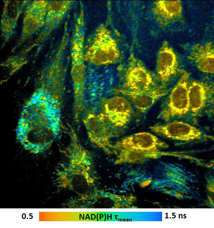 FLIM — технология будущего в биомедицине