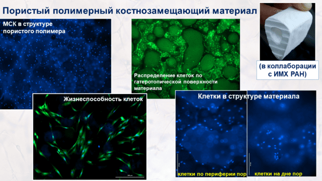 5. Разработка костнозамещающих материалов.png